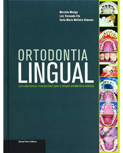 Livro: Ortodontia Lingual