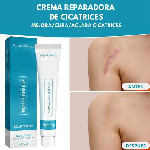 Crema Despigmentante De Manchas Para Cicatrices Paño Acne
