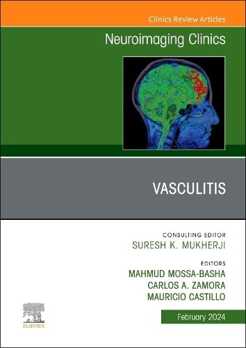  Vasculitis Issue Neuroimaging Clinics Nort America  -  Moss