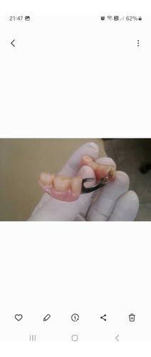 Reparación De Prótesis Dentales En Capital Federal
