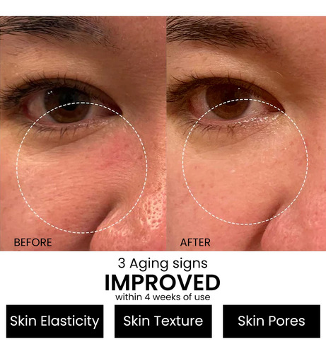 Resurgir Suero Retinol Para La Cara Con Ácido Hialurónico Vi
