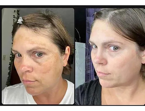 Pomada Creme Clareia Manchas Sardas Melasma Todo Tipo De Pele Dia/noite