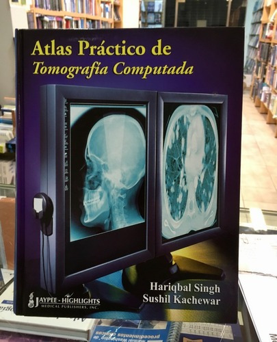 Atlas Práctico De Tomografíaputada, De Hariqbal Singh. Editorial Jaype En Español