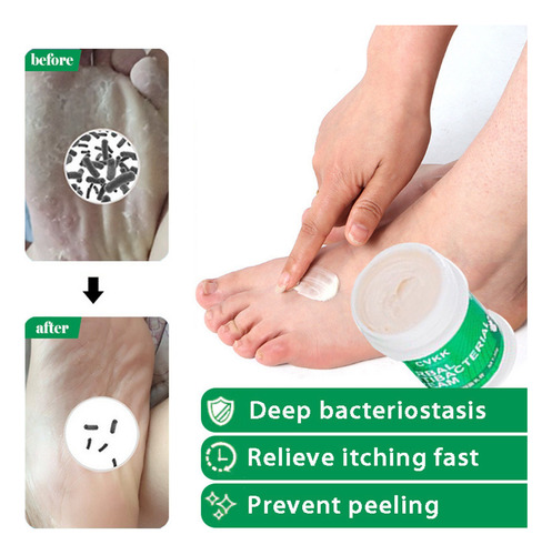 Crema Exfoliante Y Para El Cuidado De Pies Podridos Con Olor
