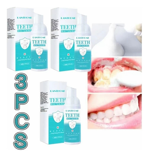 3pcs Creme Dental De Espuma Branqueadora Instantânea Dentes