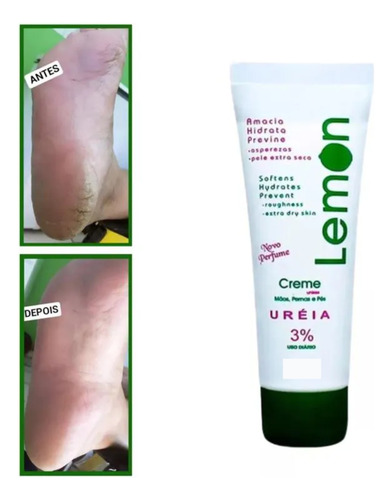 Creme De Ureia 3% Para Mãos, Pernas E Pés 45g Lemon