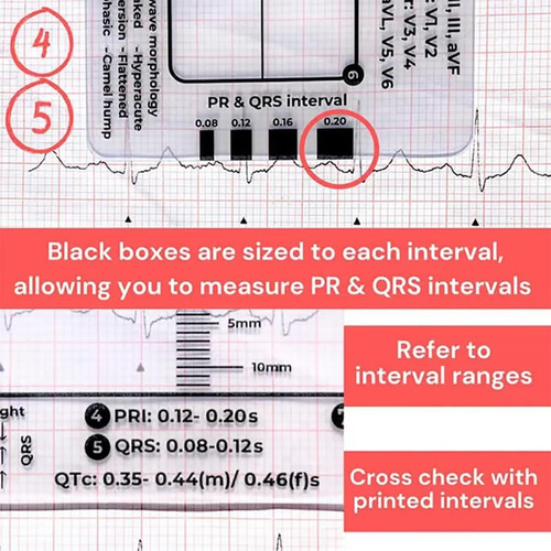 Ecg 7 Step Ruler, Ekg Calipers Pocket Ruler,ekg Pocket