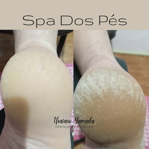 Imagem 1 de 5 de Manicure Pedicure E Spa Dos Pés