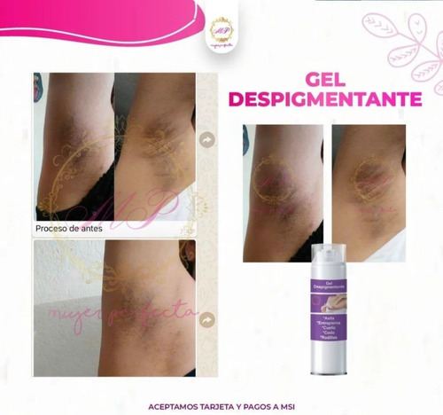 Gel Aclaradora Blanqueadora Para Entrepierna, Axilas, Cuello Neutra