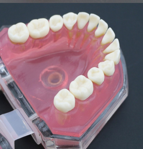 Imagen 6 de 10 de Modelo Acrílico Único Dientes Desmontables Encía Enseñanza