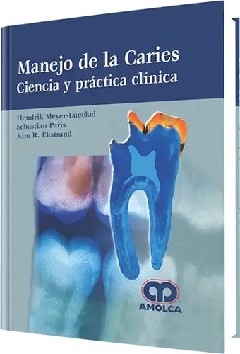 Manejo De La Caries Ciencia Y Práctica Clínica