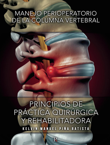 Manejo perioperatorio de la columna vertebral, de Piña Batista, Kelvin Manuel. Editorial PUNTO ROJO EDITORIAL, tapa blanda en español