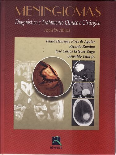 Livro Meningiomas - Diagnostico E Tr Aguiar, Paulo Henr