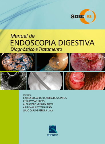 Manual de Endoscopia Digestiva: Diagnóstico e Tratamento, de SOBED - Sociedade Brasileira de Endoscopia Digestiva. Editora Thieme Revinter Publicações Ltda, capa dura em português, 2016