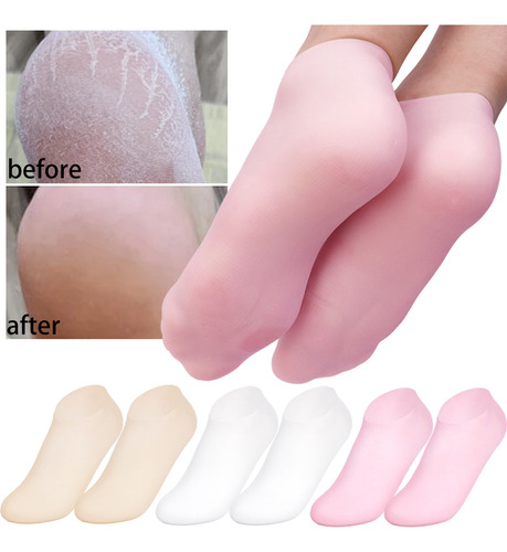 Calcetines De Gel Exfoliantes De Silicona Para Pies, 2 Pares