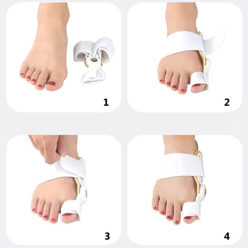 Corrector De Juanetes Hallux Valgus Ortesis, Férula