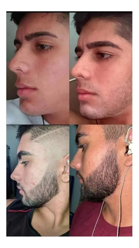 Barba Tónico 500 Gotas + Serum Capilar 120 Ml + Envio