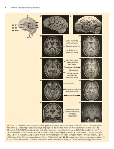 Neuroanatomia: Texto e Atlas, de Martin, John H.. Editora AMGH, capa dura em português, 2013