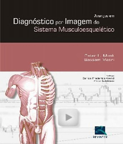 Avanços Em Diagnóstico Para Imagem Do Sistema Musculoesquelético, De Peter L. Munk. Editora Revinter, Capa Dura Em Português, 2008