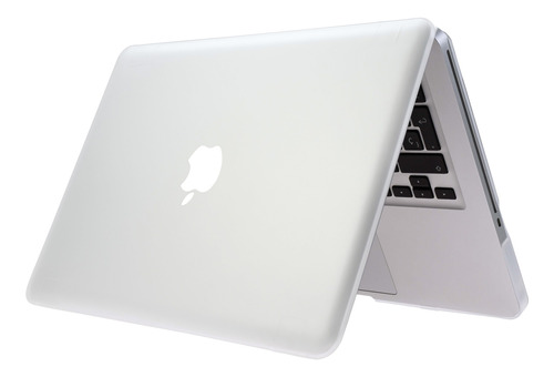 Carcasa Case Funda Protector Para Macbook Pro 15'' A1286