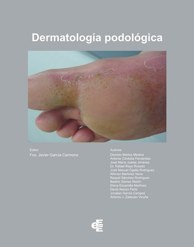 Dermatología Podológica