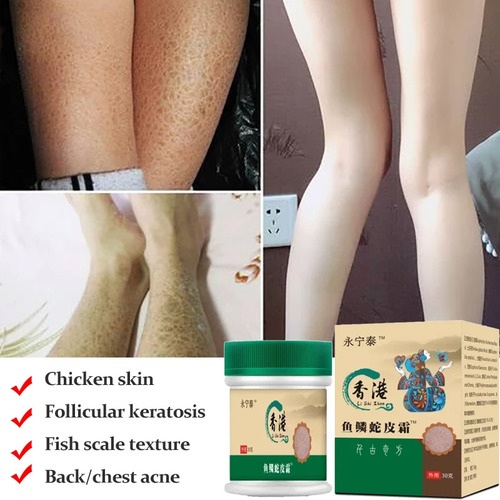 Crema Reparadora Y Removedora Para La Piel Corporal Con Trat