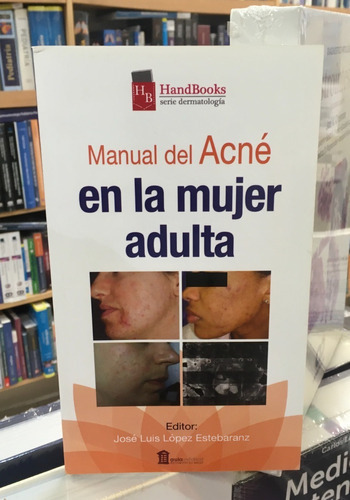 Manual Del Acné En La Mujer Adulta, De José Luis López Estebaranz. Editorial Aula Médica, Tapa Blanda En Español, 2016