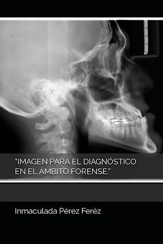Imagen Para El Diagnóstico En El Ámbito Forense.