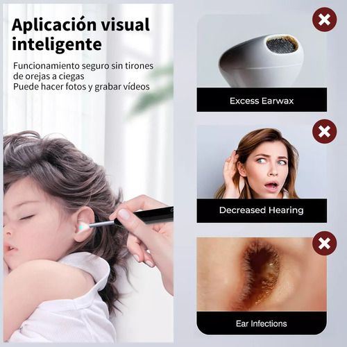 Limpiador Oidos Cámara Quita Cerilla Inteligente Endoscopio