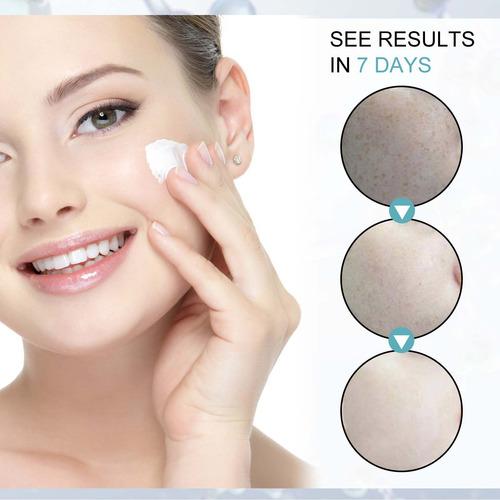 Crema Correctora E Antimanchas Para Rostro Y Cuerpo Age S