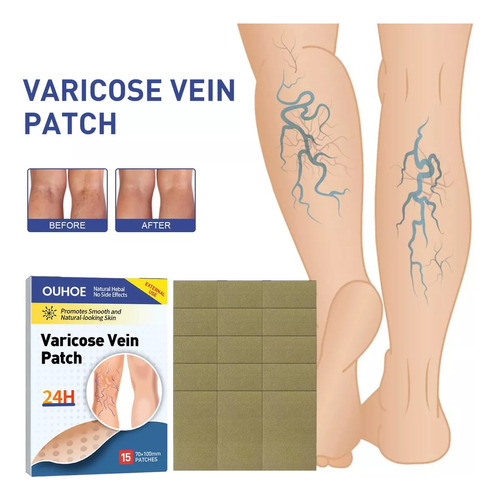 Parches Para Las Varices De Las Piernas