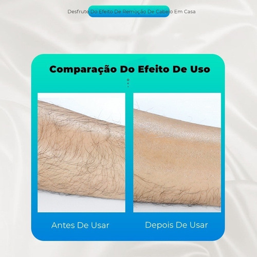 * Herramienta De Depilación Física Portátil De 1 Pieza