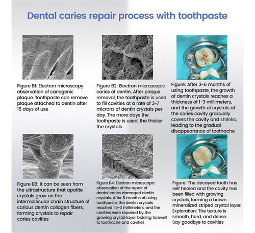 - Pasta De Dientes De Reparación Rápida For Caries 120 G*2