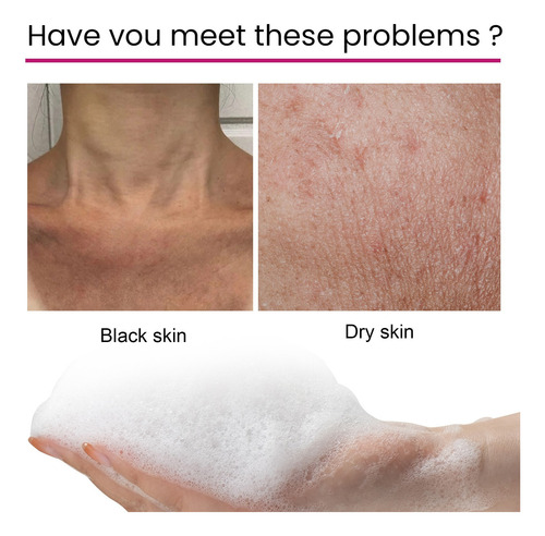 Jabón De Belleza S Que Limpia Las Arrugas De La Piel Aplanad