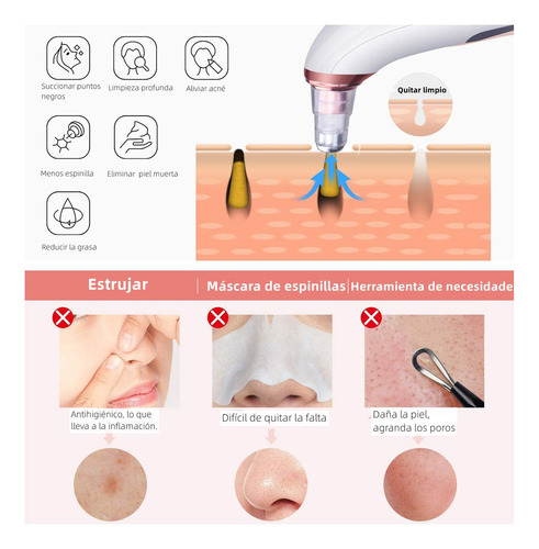 Removedor De Espinillas, Limpiador De Poros Usb Recargable