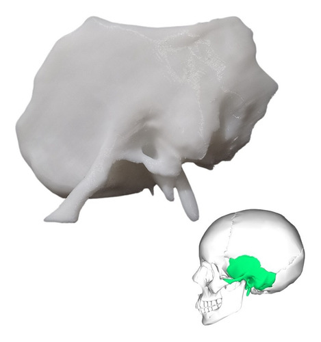 Modelo Anatómico, Hueso Temporal, Impreso 3d,tamaño 1:1.