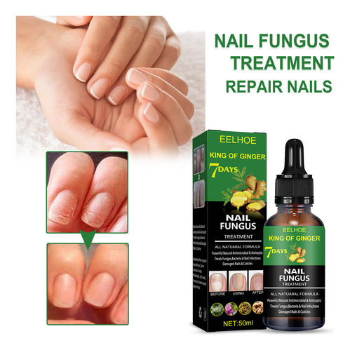 Genérica 7 Days Nail Fungus Essence Hand And Foot Serum Removal Repair Gel Anti Infection Almohadilla - Verde - Flores