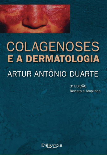 Livro Colagenoses E A Dermatologia, De Duarte. Editora Dilivros, Capa Dura, Edição 3 Em Português, 2019