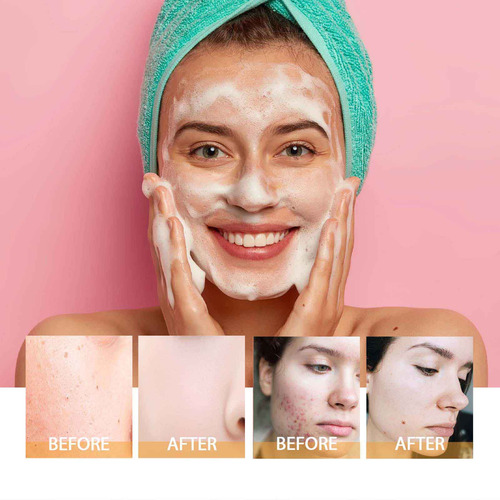 Limpiador Kójico H Turmeric, Espumas Exfoliantes, 0005