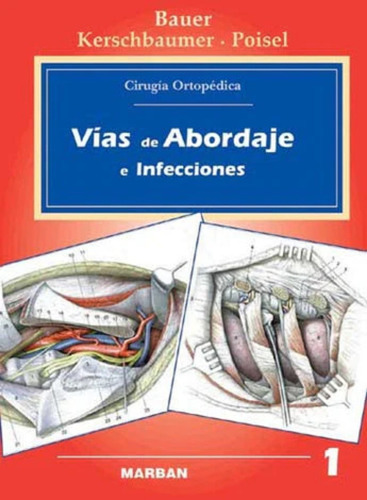 Cirugía Ortopédica. Vol 1 Vías De Abordajes E Infecciones