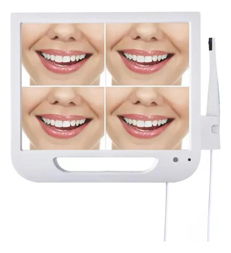 Cámara Dental Intraoral Inalámbrica Con Monitor De 17 Pulgad