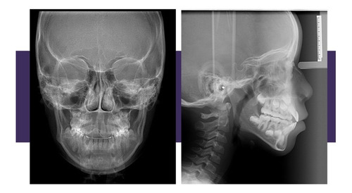 Radiografías Panorámicas, Teleradiografias Y Estudios Cef.