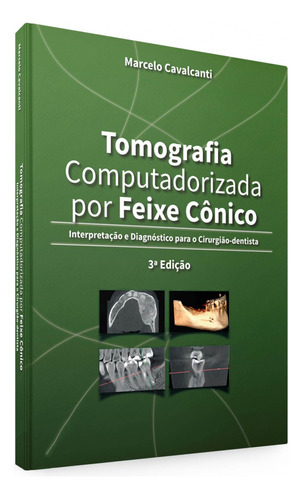 Livro Tomografia Computadorizada Por Feixe Cônico
