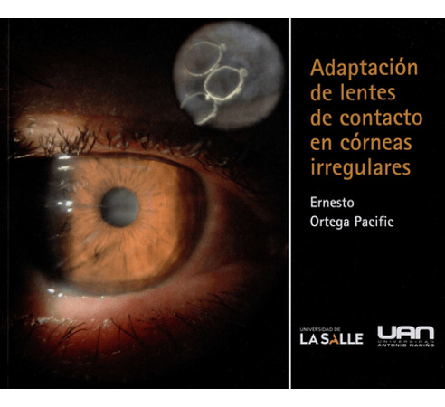 Libro Adaptacion De Lentes De Contacto En Corneas Irregular