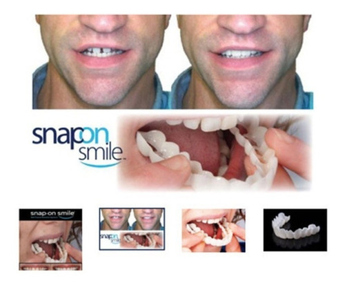 Imagen 3 de 5 de Sonrisa Perfecta Dentadura Dientes Blancos Relucientes Minut