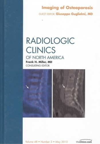 Libro Imaging Of Osteoporosis Radiologic Clinics Of North Am