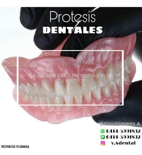 Prótesis Dentales