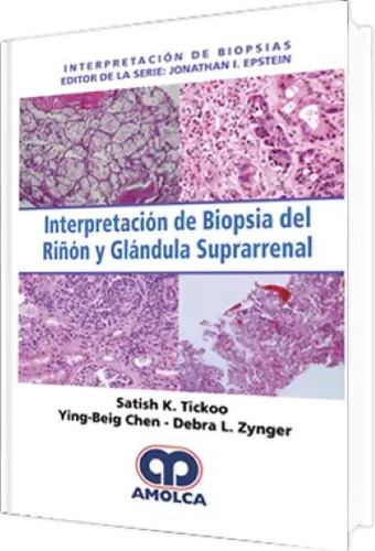 Interpretación De Biopsia Del Riñón Y Glándula Suprarrenal
