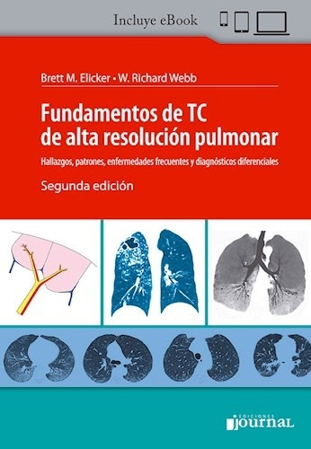 Fundamentos De Tc De Alta Resolucion Pulmonar 2 Ed - Elicker