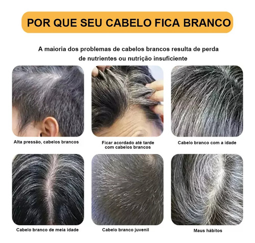 X Champú Oscurecedor Y Jabón En Barra Oscurecedor De 3